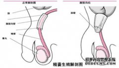 精囊炎有哪些危害